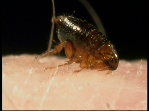 猫蚤(Ctenocephalides felis)以人的皮肤为食，浑身是血视频素材
