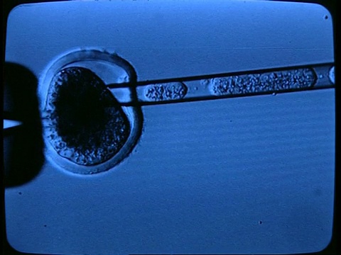 BCU从细胞中提取细胞物质，在显微镜下视频下载