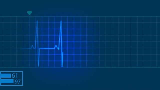 心电图，心电图，脉搏描记心脏监护仪视频下载