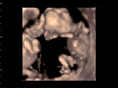 双胞胎胎儿在子宫中移动，4D超声扫描。视频素材