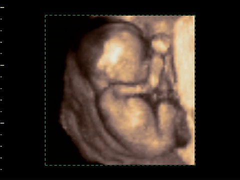 胎儿从子宫侧面开始，4D超声。视频下载