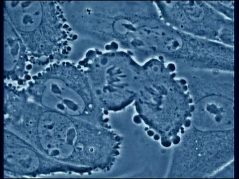 突变DNA的显微照片。视频下载