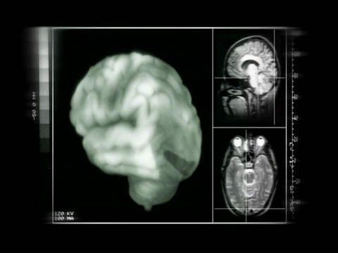 大脑旋转的图形图像，图像右侧是横截面视频下载