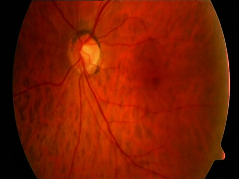 在检查光下通过眼睛将视网膜缩小视频下载