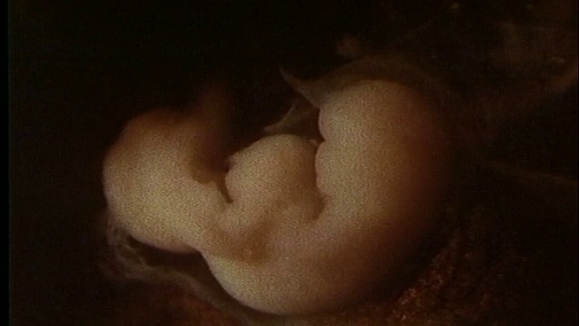 显微镜- 4周/出生后第一天的人类胚胎视频下载