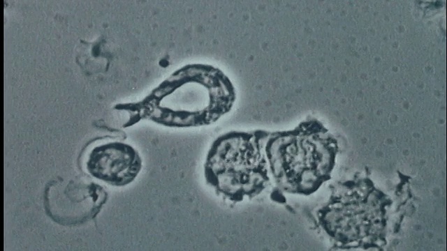 显微镜下-人巨噬细胞/艾滋病病毒视频下载
