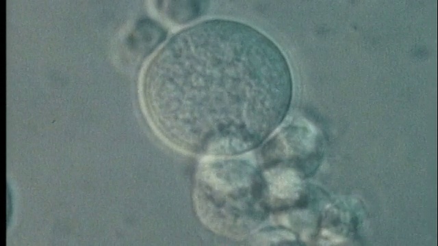显微镜-人淋巴细胞死于艾滋病病毒/艾滋病病毒视频下载