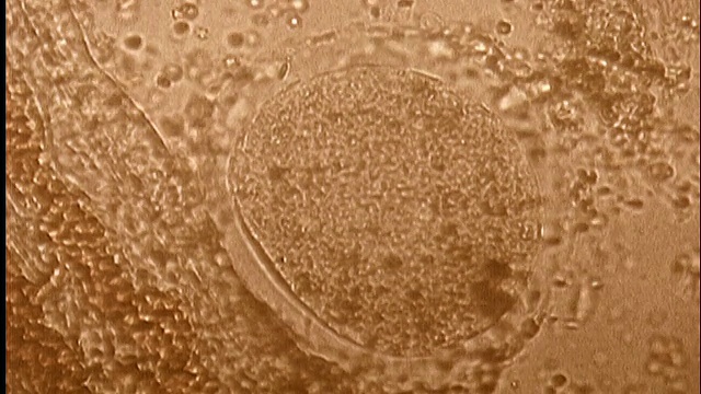 显微镜下-受精时/生命初期的卵细胞(卵)视频下载