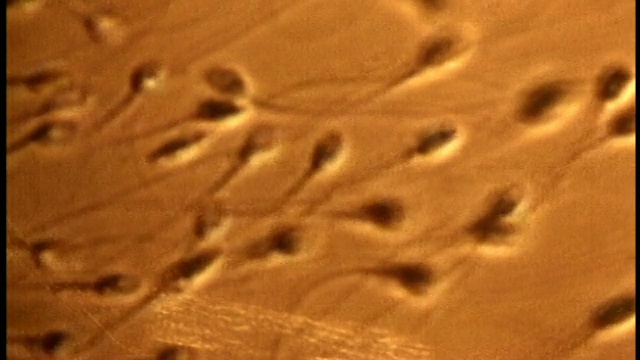 显微镜下-被卵母细胞吸引的极近距离的精子群视频下载