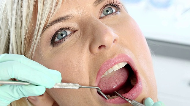 牙科手术视频素材