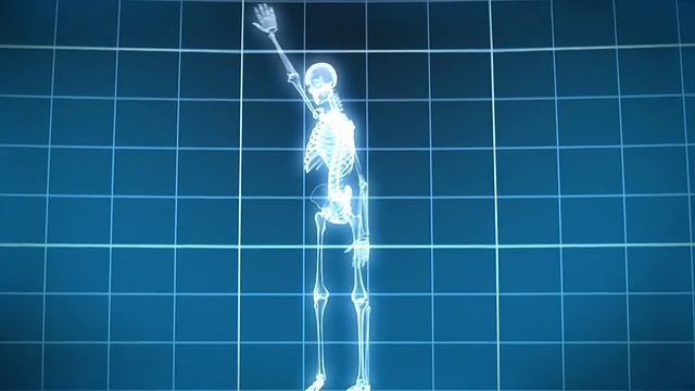 x射线骨架跳舞视频下载