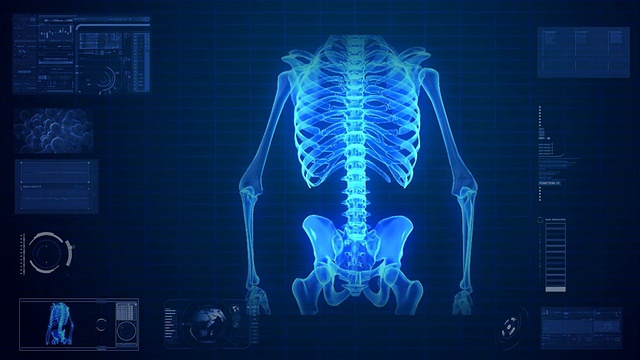 人体骨骼的x射线扫描视频下载