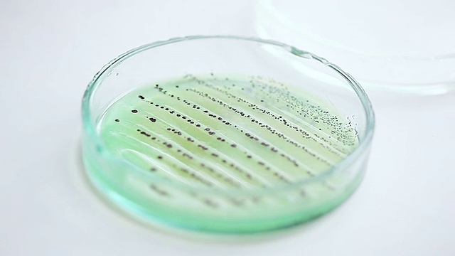 皮氏培养皿中的菌落。科学背景视频下载