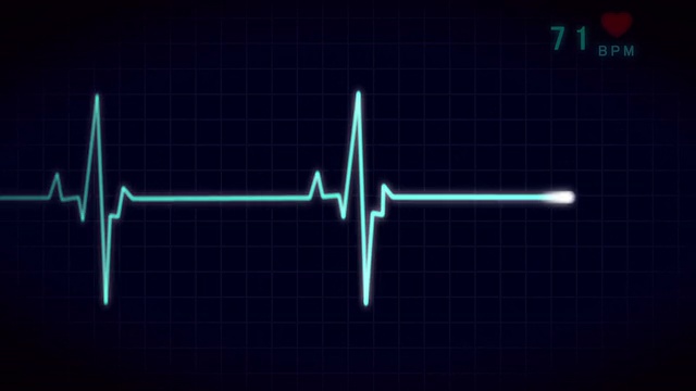 心电图，心电图，脉搏描记心脏监护仪视频下载