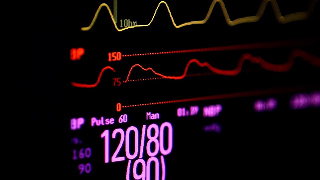血压监护仪视频素材