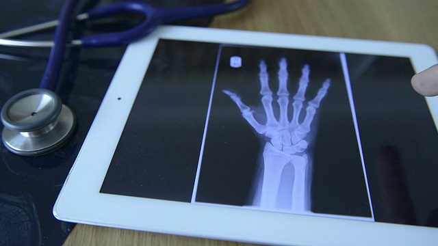 医生在平板电脑上检查x射线图像视频下载
