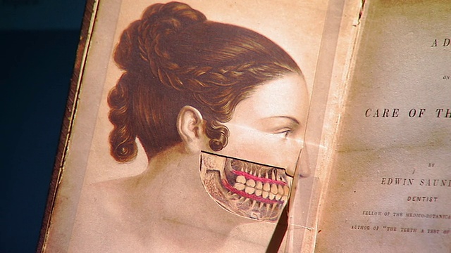 图为英国维多利亚女王私人牙医埃德温·桑德斯(美国马里兰州巴尔的摩)的《牙齿护理》一书中人类下颌的插画视频下载