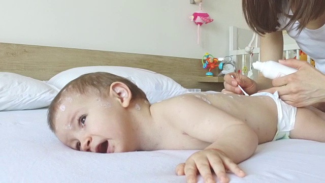 母亲在照顾患水痘的婴儿视频下载