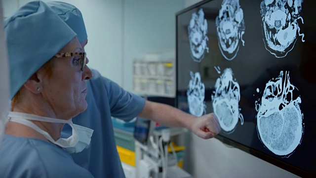 两个外科医生在讨论一个头部的CT扫描视频下载