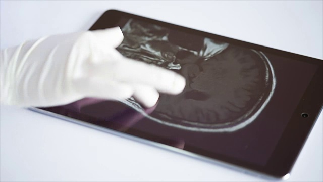 医生在平板电脑上检查图像x射线MRI。视频下载