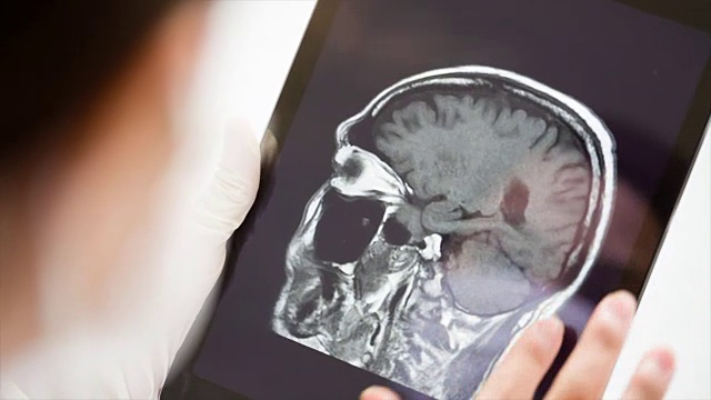 医生在平板电脑上检查图像x射线MRI。视频素材