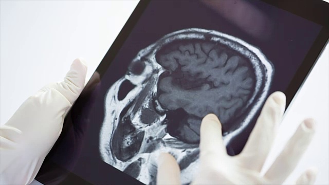 医生在平板电脑上检查图像x射线MRI。视频素材