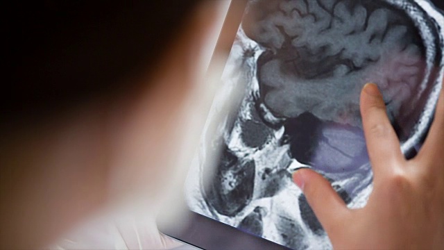 医生在平板电脑上检查图像x射线MRI视频素材