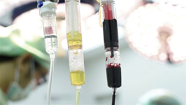 医生给予静脉输液，包装红血球和新鲜冷冻视频下载