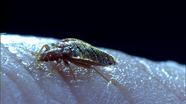 臭虫栖息在人的皮肤上。视频素材