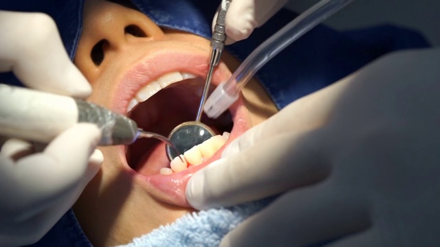 牙科诊所提供牙科清洁服务视频素材