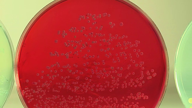 平移一排含有细菌样本的培养皿。视频素材