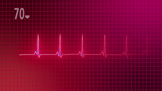 4K心电图心脏监护仪视频下载