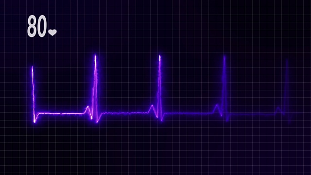 4K心电图心脏监护仪视频下载