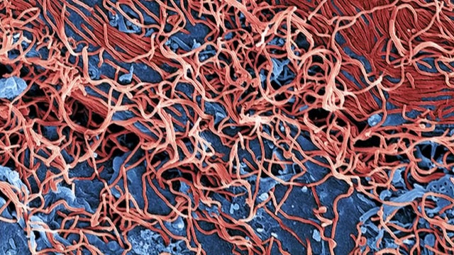 “埃博拉病毒从细胞中萌发，SEM”视频素材