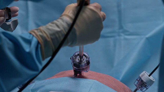 腹腔镜手术的外科医生视频下载