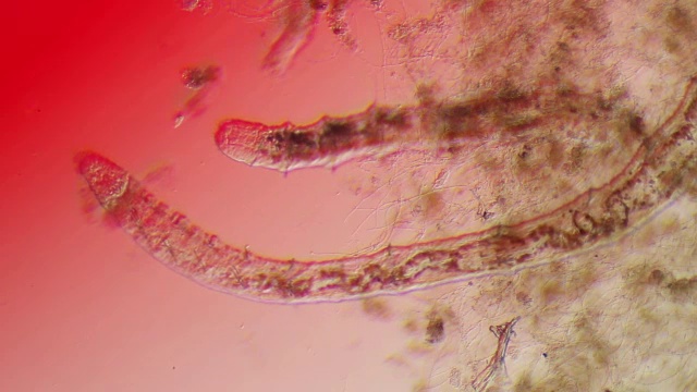显微镜下的蠕虫-少毛纲Naididae视频下载