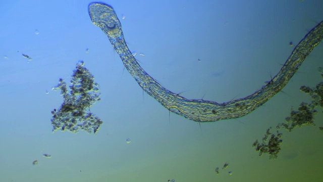 显微镜下的蠕虫-少毛纲Naididae视频下载