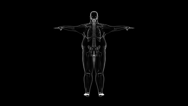 骨骼超重男子的x光片视频素材