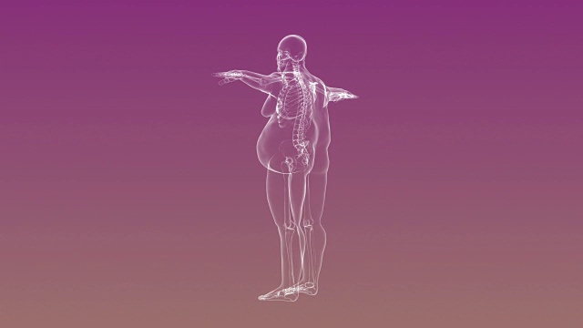 骨骼超重男子的x光片视频素材