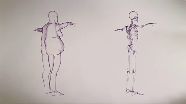 超重者和骷髅的x光照片视频素材