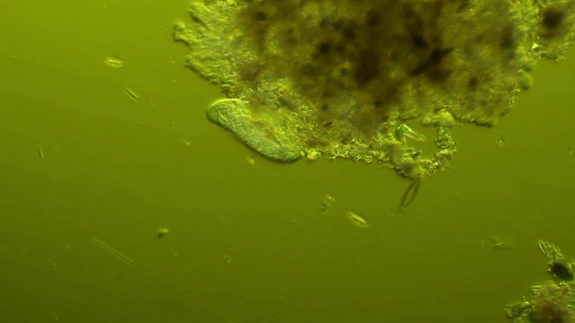 微生物—原生动物视频下载