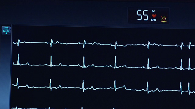 心脏跳动的正弦波在心电图监视器上的特写。视频下载