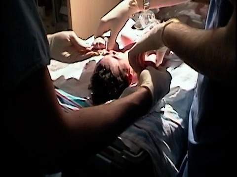 中镜头医院工作人员对新生儿进行阿普加试验视频素材