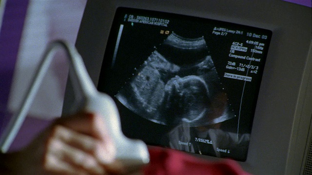 选择性聚焦特写医生对孕妇进行超声检查/背景监测视频下载