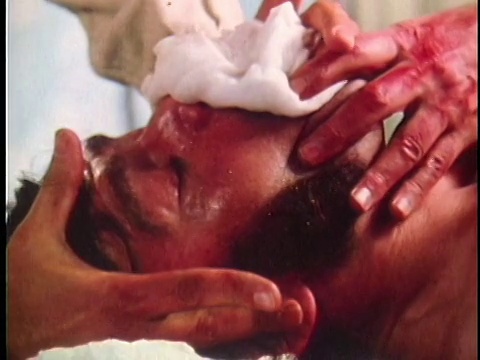 1971年，重演美国内战士兵在麻醉下尖叫着躺在手术台上/ 19世纪的美国/音频视频下载