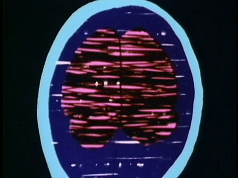 1986年，CGI，卡通显示人体横截面与吸烟造成的损害，美国，音频视频下载