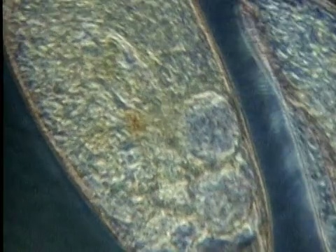1985年，草履虫四处移动和相互碰撞的显微镜观察视频下载