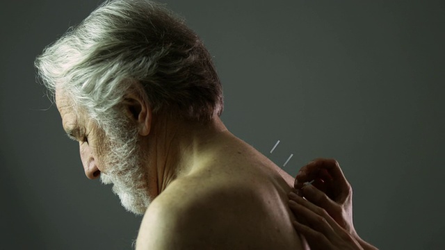 SLO MO MS TD女人应用针灸针到男人的背部在工作室/纽约，纽约州，美国视频下载