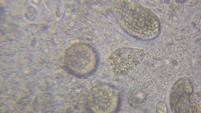 水中原生动物微生物的显微镜图像片段，显示纤毛虫，草履虫，细菌螺旋体和藻类。视频下载