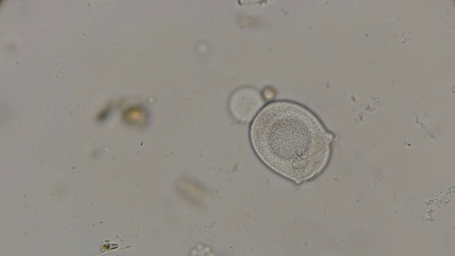 钟形纤毛虫涡虫在显微镜下自由游动视频下载